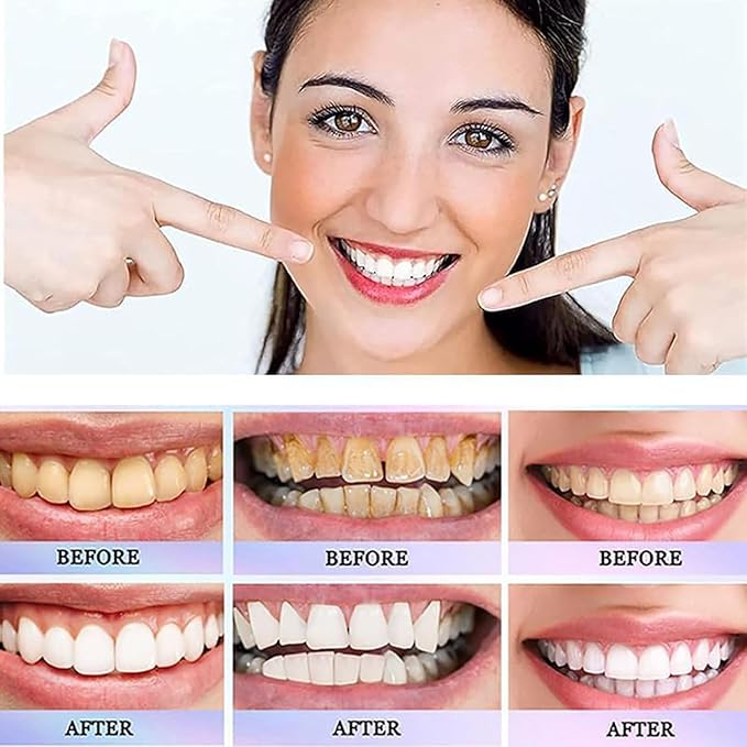 Nicotinamide toothpaste promotional graphic with before-and-after teeth examples