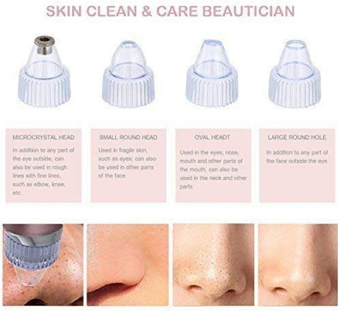 Pore cleaning device attachment heads with microcrystal and round nozzle tips