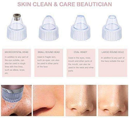 Pore cleaning device attachment heads with microcrystal and round nozzle tips