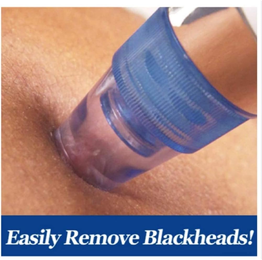 Pore cleaning device nozzle pressed on skin with blue head