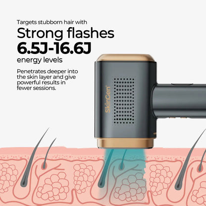 SkinGen Sapphire Ice IPL device with treatment window directed at a skin diagram