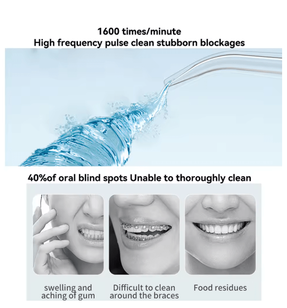 Oral irrigator with a curved nozzle emitting a high-frequency water pulse
